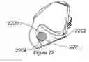 Fig. 20 - Nozzle bore for high flow rates