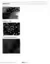 Fig. 07 - Processes and compositions for adenovirus purification using continuous flow centrifugation