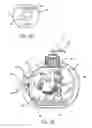 Fig. 04 - Fluid container