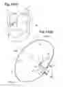 Fig. 07 - Airbag apparatus