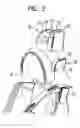 Fig. 03 - Side impact protective device, integrated in a seat, and a head side gas bag module, integrated in a seat