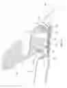 Fig. 08 - Molding apparatus for vehicles and methods for use