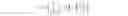 Fig. 10 - Edge dependent motion blur reduction