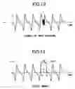 Fig. 13 - Audio signal processing method, audio signal processing apparatus, Hi-Fi video apparatus, digital video apparatus and 8 mm video apparatus
