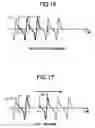 Fig. 15 - Audio signal processing method, audio signal processing apparatus, Hi-Fi video apparatus, digital video apparatus and 8 mm video apparatus