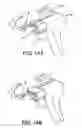 Fig. 12 - Device for determining the position of an incision block