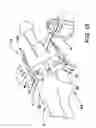 Fig. 13 - Device for determining the position of an incision block