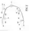 Fig. 03 - String lamps device