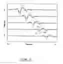 Fig. 07 - Method and apparatus for cement bond evaluation using transversely polarized shear waves