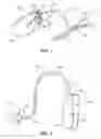 Fig. 02 - Method of manufacturing hearing aid ear tube