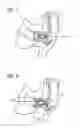 Fig. 02 - Ear insert for hearing aids