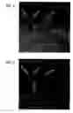 Fig. 02 - Method for filtering tomographic 3D images after completed reconstruction of volume data
