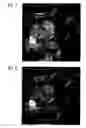 Fig. 05 - Method for filtering tomographic 3D images after completed reconstruction of volume data