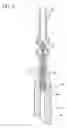 Fig. 04 - Low water peak optical waveguide fiber