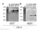 Fig. 06 - Pramyxovirusl vectors encoding antibody and utilization thereof