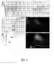 Fig. 10 - Urocortin proteins and uses thereof