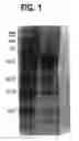 Fig. 02 - Isolated components of dense microspheres derived from mammalian brain tissue and antibodies thereto