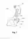 Fig. 07 - Bicycle derailleur