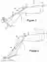 Fig. 06 - Apparatus for use in exercising