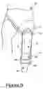 Fig. 07 - Apparatus for use in exercising