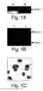 Fig. 02 - Eosinophil Major Basic Protein as a natural heparanase-inhibiting protein, compositions, methods and uses thereof