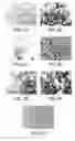 Fig. 04 - Dipeptide apoptosis inhibitors and the use thereof