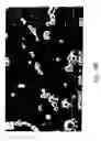 Fig. 08 - Compositions and methods for treating or preventing diseases of body passageways