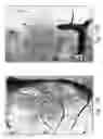 Fig. 30 - Compositions and methods for treating or preventing diseases of body passageways