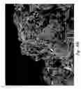 Fig. 84 - Compositions and methods for treating or preventing diseases of body passageways