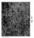 Fig. 86 - Compositions and methods for treating or preventing diseases of body passageways