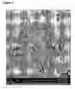 Fig. 08 - Slow release steroid composition