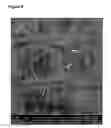 Fig. 09 - Slow release steroid composition