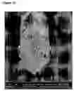 Fig. 10 - Slow release steroid composition