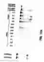 Fig. 13 - Method of treating or preventing hepatitis B virus
