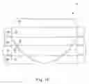 Fig. 07 - Denture care method and kit