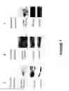 Fig. 22 - Novel death domain proteins