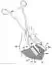 Fig. 01 - Seam closure device and methods