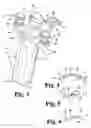 Fig. 03 - Instruments and methods for minimally invasive tissue retraction and surgery