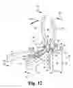 Fig. 06 - Instruments and methods for minimally invasive tissue retraction and surgery