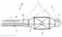 Fig. 01 - Catheter for inserting into a vessel