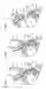 Fig. 07 - Blood pressure measuring device