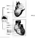 Fig. 12 - Diagnostic method utilizing standard lead ECG signals
