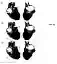 Fig. 16 - Diagnostic method utilizing standard lead ECG signals