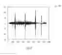 Fig. 04 - Cardiac rhythm management system with noise detector