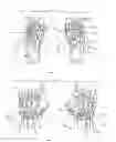 Fig. 02 - Methods for treating opthalmalogical conditions using micro-acupuncture