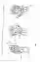 Fig. 06 - Methods for treating opthalmalogical conditions using micro-acupuncture