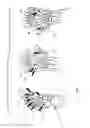 Fig. 07 - Methods for treating opthalmalogical conditions using micro-acupuncture