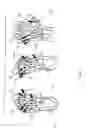 Fig. 09 - Methods for treating opthalmalogical conditions using micro-acupuncture