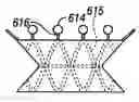 Fig. 01 - Devices for maintaining surgically created openings