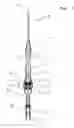 Fig. 02 - Safety indwelling needle